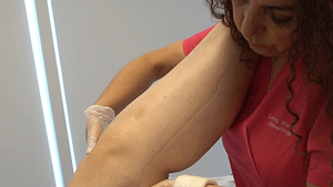 Lipedema Experts Summit: congreso internacional aterriza en Chile con foco en pacientes y formación médica